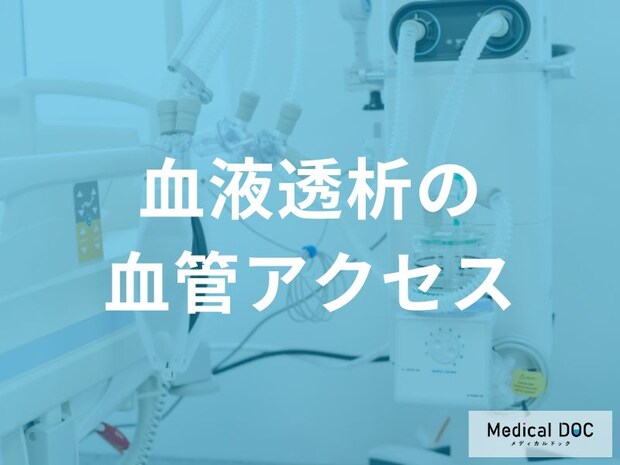 「血液透析」での『内シャント』の作製方法と管理のポイント、注意点を医師が解説
