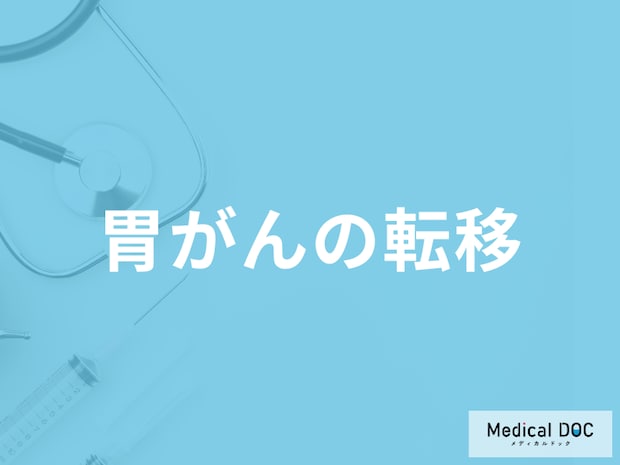 「胃がんが移転する」とどんな症状が現れるかご存じですか？移転しやすい部位も解説！