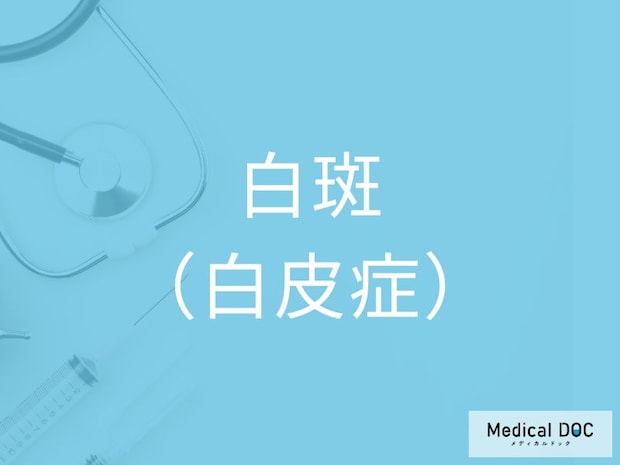 白斑のリスクが高い人の特徴とは？今すぐチェックすべき5つのポイント