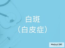 白斑のリスクが高い人の特徴とは？今すぐチェックすべき5つのポイント