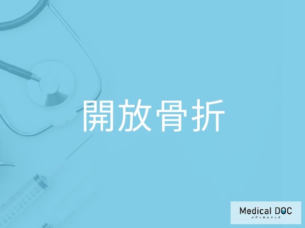 “骨が見えるケガ“の「開放骨折」 知らないと危険な3つのリスクを医師が解説