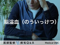 「脳溢血（のういっけつ）」とは？治療法・前兆・原因についても解説！
