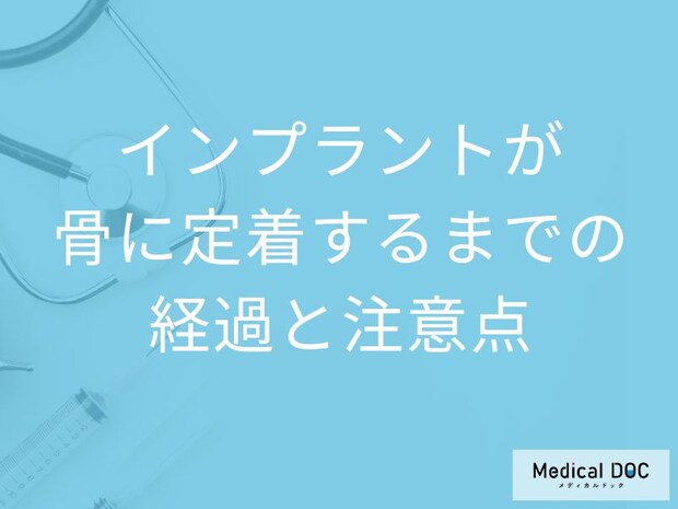インプラントが骨と結合するまでの期間は? 治療中の食事・生活・注意点【歯科医師解説】