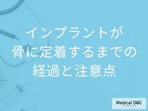 インプラントが骨と結合するまでの期間は? 治療中の食事・生活・注意点【歯科医師解説】