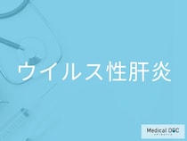 「ウイルス性肝炎」の初期症状とは？ 倦怠感・黄疸が示す危険信号を医師が解説