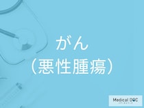 「がん」の初期症状を医師が解説 無症状のうちに進む危険な特徴とは