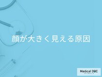 顔が大きく見える原因は骨格だけじゃない? むくみ・筋肉の癖を医師が解説