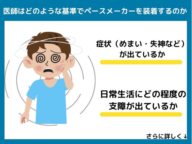 医師はどのような基準でペースメーカーを装着するのか