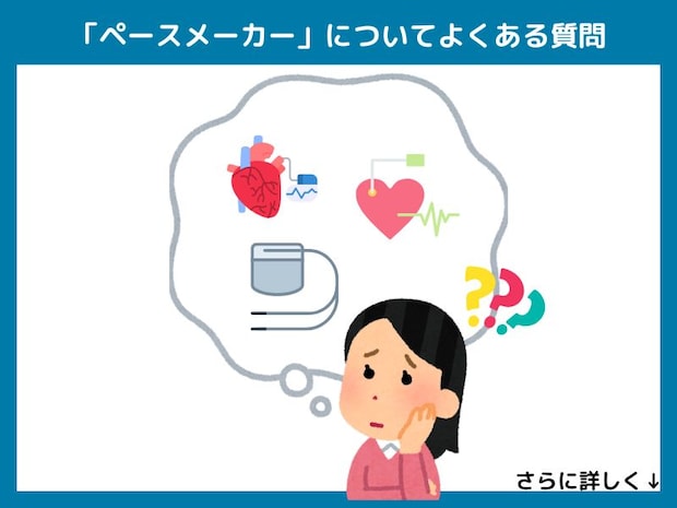 「ペースメーカー」についてよくある質問