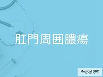 「肛門周囲膿瘍」のリスクが高い人は？ 今すぐ確認したい5つの特徴を医師が解説