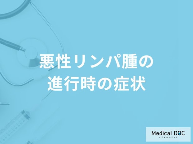 「悪性リンパ腫の進行時の症状」はご存知ですか？【医師監修】