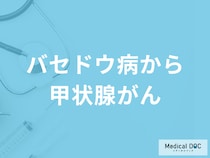 「バセドウ病から甲状腺がんになる」ことはある？甲状腺がんの症状も医師が解説！