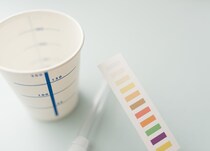 尿検査の早朝尿の重要性を医師が解説 採尿が朝一じゃないとダメな理由や検尿結果への影響とは？