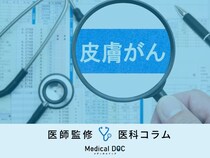 「皮膚がん」に気づくキッカケはご存じですか? 症状･原因･なりやすい人の特徴を医師が解説!