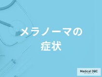 「メラノーマの症状」はご存知ですか？転移しやすい部位も解説！【医師監修】