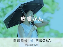 「皮膚がん」を疑う症状・原因はご存知ですか？医師が監修！