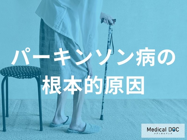 「パーキンソン病の根本原因」を医師が解説 ドパミン低下とレビー小体の正体とは