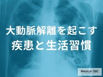 「大動脈解離のリスクが高い人」の特徴をご存じですか？ 生活習慣で分かる危険サインを医師に聞く