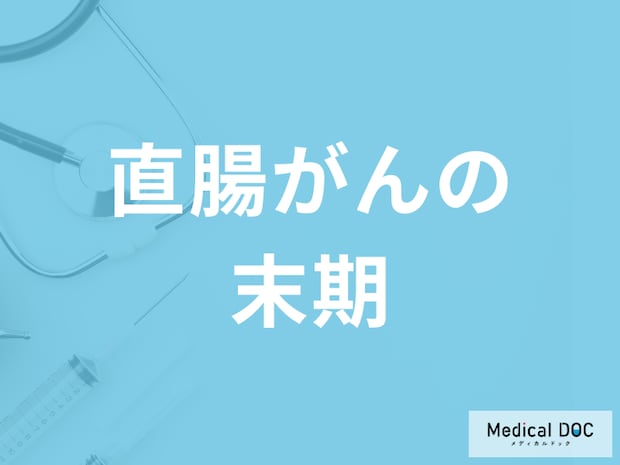 「直腸がんの末期症状」はご存知ですか?ステージ4=末期ではない理由も解説!