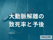 「大動脈解離の死亡率」が時間とともに急上昇する理由をご存じですか？【医師監修】