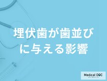 「埋伏歯が歯並びにどのような影響を与える」のかご存じですか？医師が解説！
