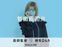 「智歯周囲炎」の原因・発症しやすい年齢層はご存知ですか？医師が監修！