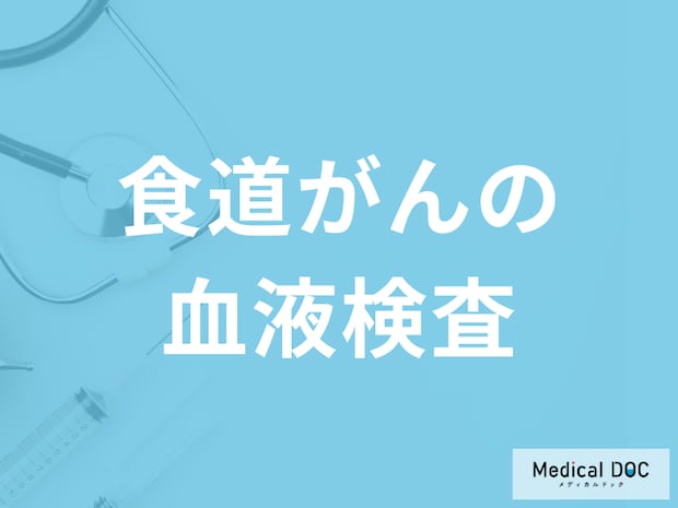 「食道がんで行う血液検査」はご存知ですか？進行してから現れる症状も医師が解説！