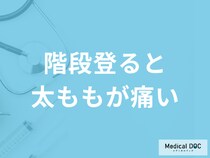 「階段を登ると太ももが痛い」原因はご存知ですか？医師が監修！