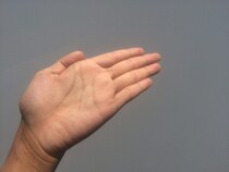 手掌多汗症の症状や原因、治療方法とは？