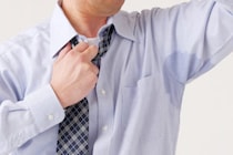 多汗症の症状や原因、治療方法とは？