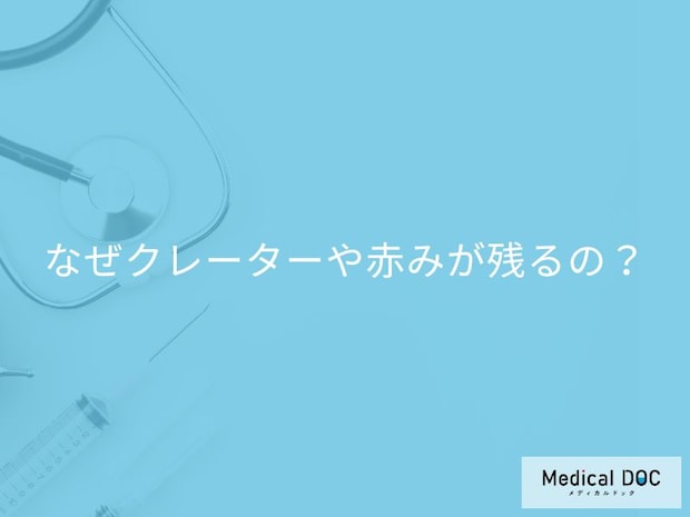 放置はNG! なぜニキビ跡がクレーターや赤みに？皮膚の奥で起こるダメージの正体【医師解説】