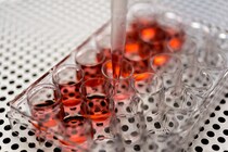 iPS細胞でがんの分子標的薬探しの効率化へ