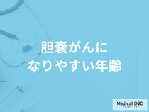 女性に多い「胆嚢がん」のなりやすい年齢層はご存知ですか？【医師監修】