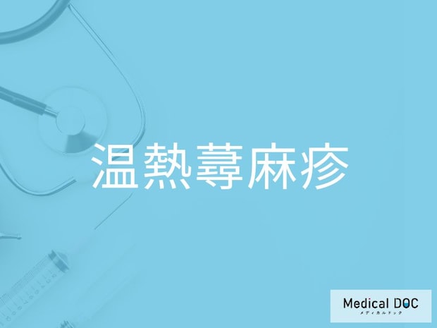“暖かいだけで発症する蕁麻疹”をご存じですか？ 「温熱蕁麻疹」の初期症状を医師に聞く