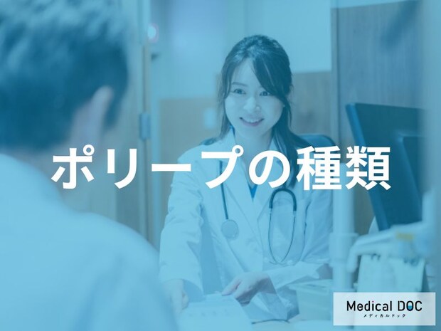 「胃カメラ」で発見される「ポリープの種類」はご存知ですか？【医師監修】