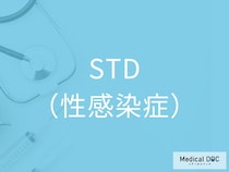 「STD（性感染症）」の初期症状を医師が解説 男女で違う“見逃されがちな症状”一覧