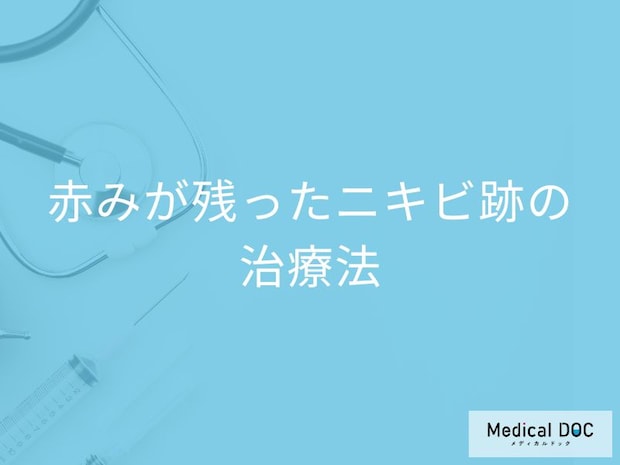 赤いニキビ跡は保険で治せる? 塗り薬・漢方薬が効かない時の治療法とは【医師解説】