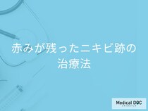 赤いニキビ跡は保険で治せる? 塗り薬・漢方薬が効かない時の治療法とは【医師解説】