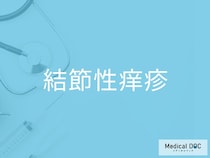 「結節性痒疹」はなぜ治らないのかご存じですか？ 激しいかゆみを繰り返す“悪循環の正体”とは