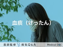 「血痰（けったん）」とは？症状・原因・治療方法も解説！【医師監修】