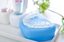 インプラント治療後にマウスピースを使用するメリットやデメリットを紹介