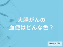 「大腸がんの血便」はどんな色かご存知ですか？医師が徹底解説！