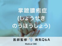 「掌蹠膿疱症」を発症しやすい人の特徴・予防法はご存知ですか？医師が監修！