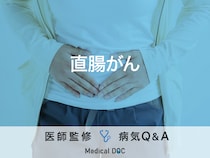 「直腸がん」になると現れる初期症状や原因はご存知ですか？ステージについても解説！