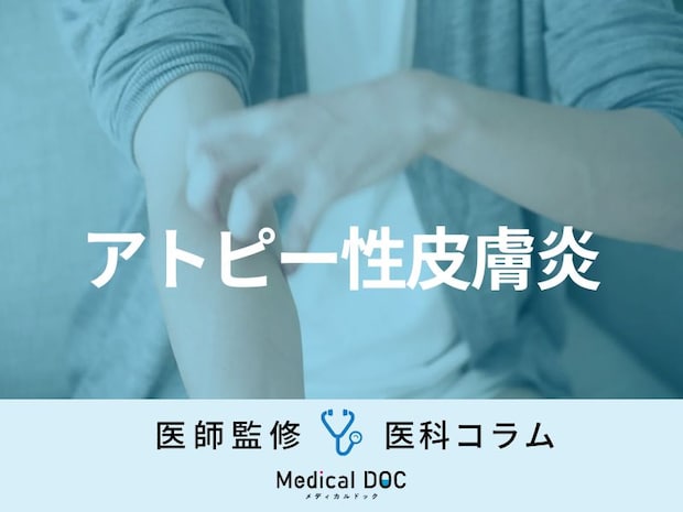 「アトピー性皮膚炎」の原因はご存じですか? “アレルギー体質”だとなりやすいって本当?【医師解説】