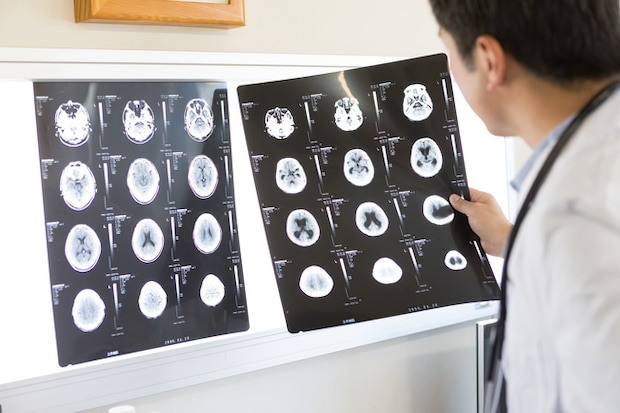 失語症による絶望感を乗り越えて