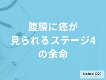 「腹膜にがんが見られるステージ4の余命」はどれくらいかご存じですか？医師が解説！