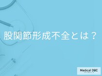 股関節形成不全って何？ 女の子に多い原因と症状を医師が解説