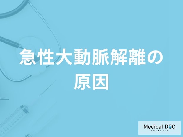 「急性大動脈解離の主な3つの原因」はご存知ですか？急死する原因も医師が解説！