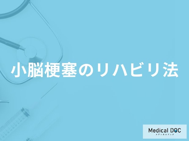「小脳梗塞のリハビリ法」はご存知ですか？医師が徹底解説！